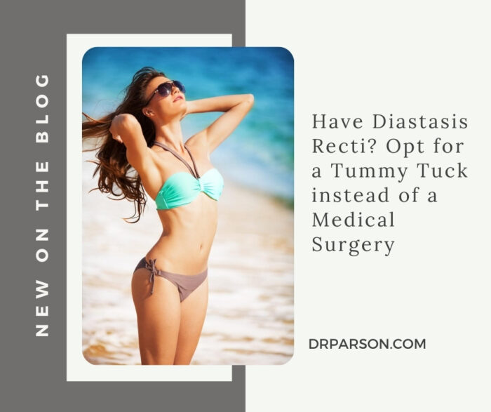 Have Diastasis Recti Opt For A Tummy Tuck Dr Shaun Parson