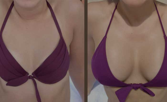 Video FAQ: Breast Augmentation - How Long Will It Last? | Dr. Shaun Parson Plastic Surgery Scottsdale