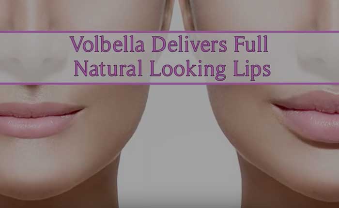 Volbella Lip Filler | Dr. Shaun Parson Plastic Surgery