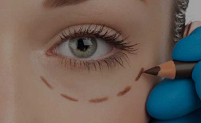 Brow lift | Dr. Shaun Parson Plastic Surgery Scottsdale