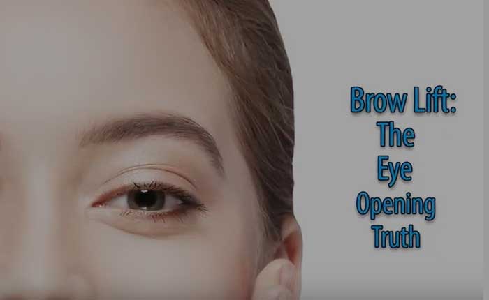 Brow lift | Dr. Shaun Parson Plastic Surgery Scottsdale