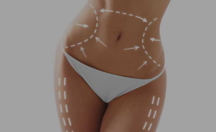 Liposuction | Dr. Shaun Parson Plastic Surgery Scottsdale