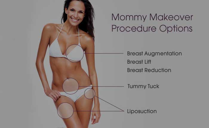 Mommy Makeover | Dr. Shaun Parson Plastic Surgery Scottsdale