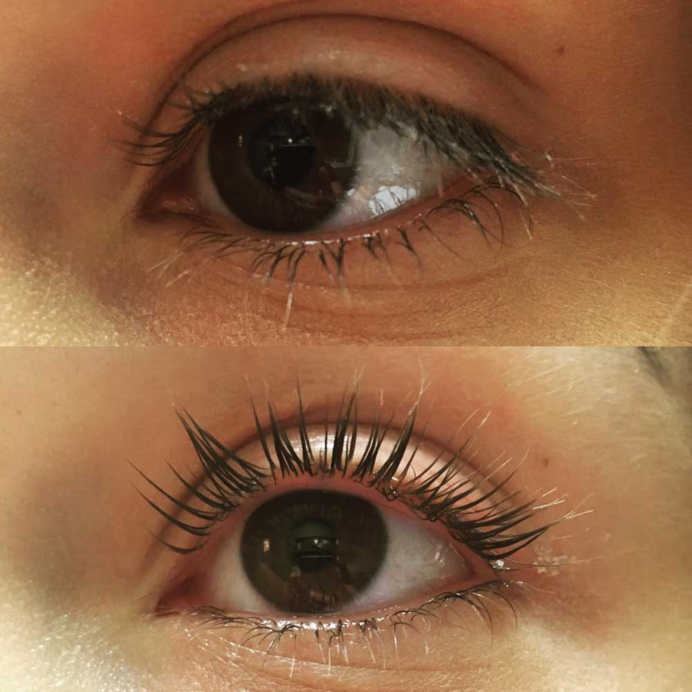 Eyelash Perm and Tint Patient 2 | Parson Skin Center and MediSpa, Scottsdale