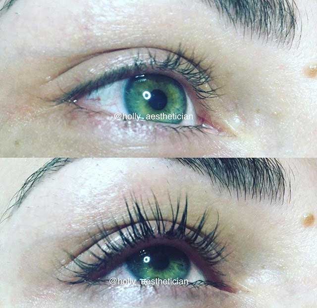 Eyelash Perm and Tint Patient 3 | Parson Skin Center Scottsdale