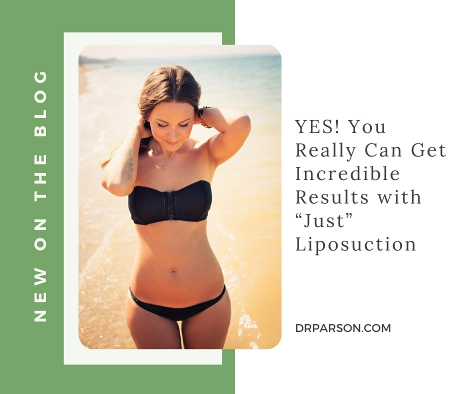 YES! Get Results with “Just” Liposuction