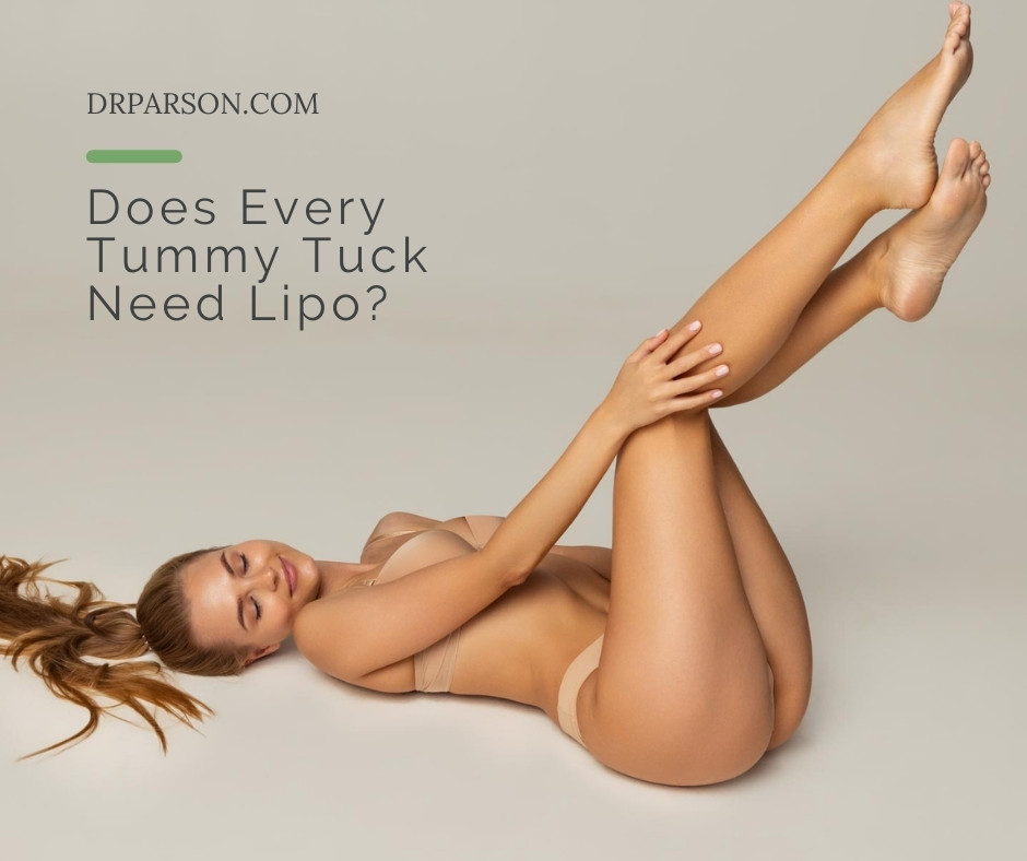 Does Every Tummy Tuck Need Lipo? | Dr. Shaun Parson, Scottsdale