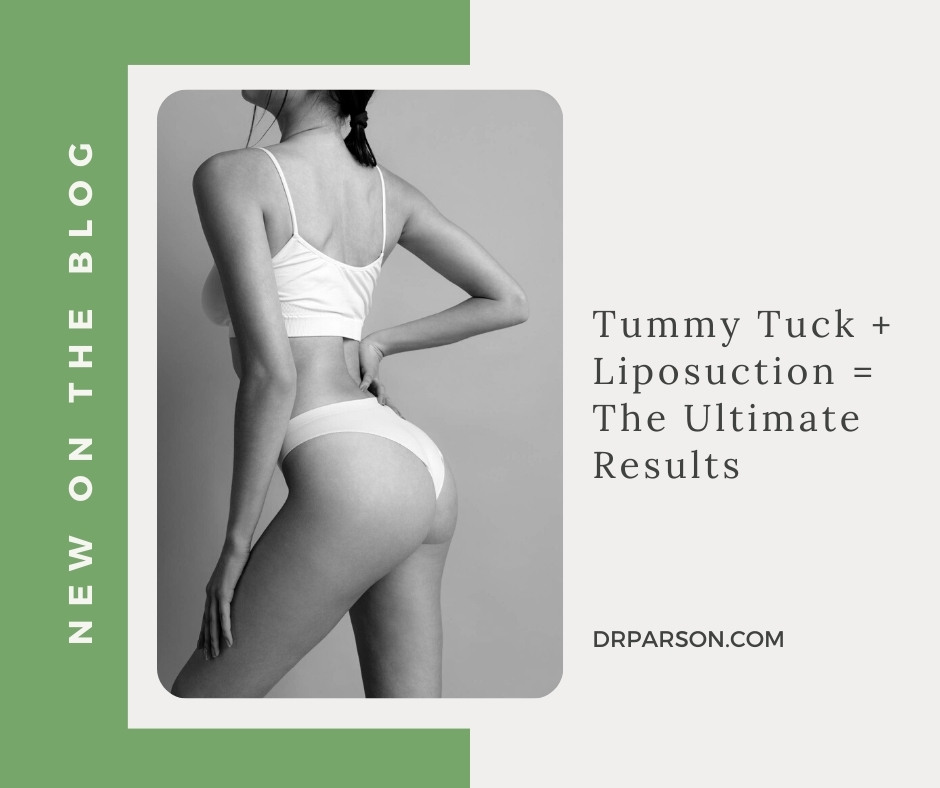 Tummy Tuck + Liposuction = Ultimate Results | Dr. Shaun Parson