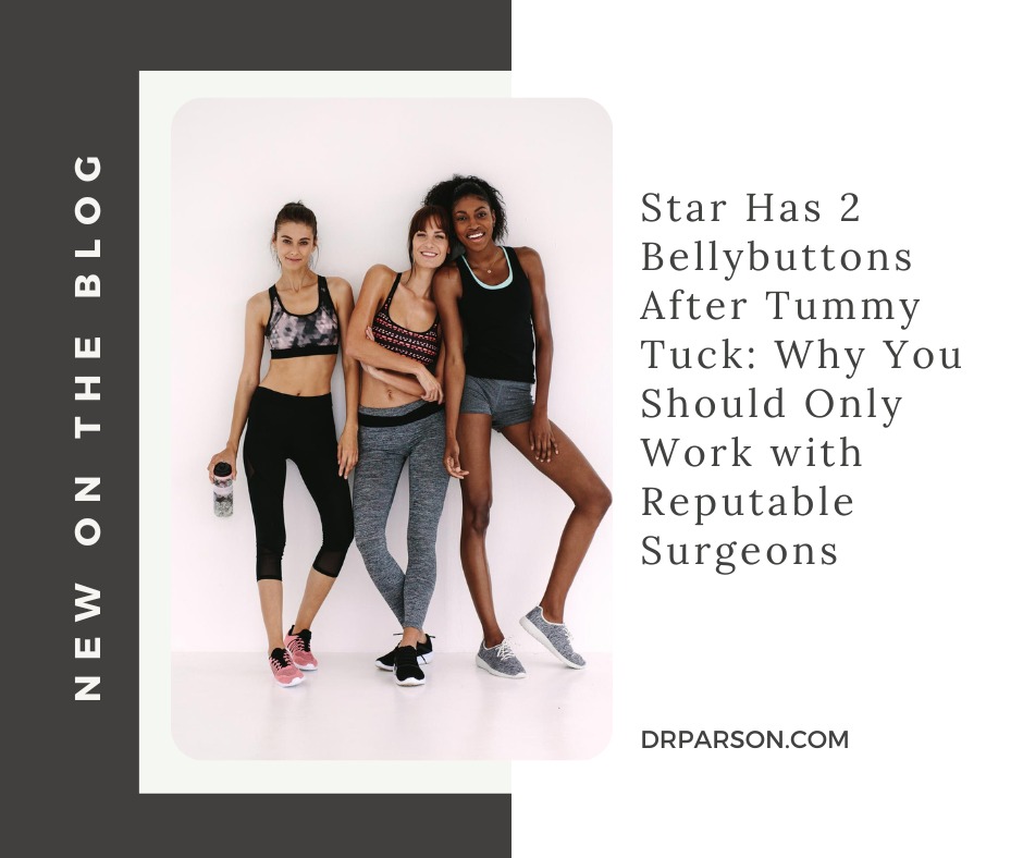 Star Has 2 Bellybuttons After Tummy Tuck | Dr. Shaun Parson