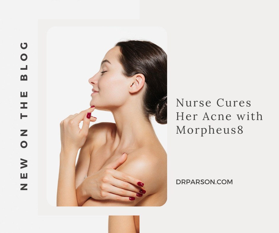 Nurse Cures Her Acne with Morpheus8 | Dr. Shaun Parson