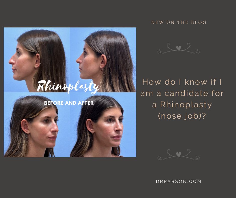 Am I Candidate for nose job? | Dr.Shaun Parson