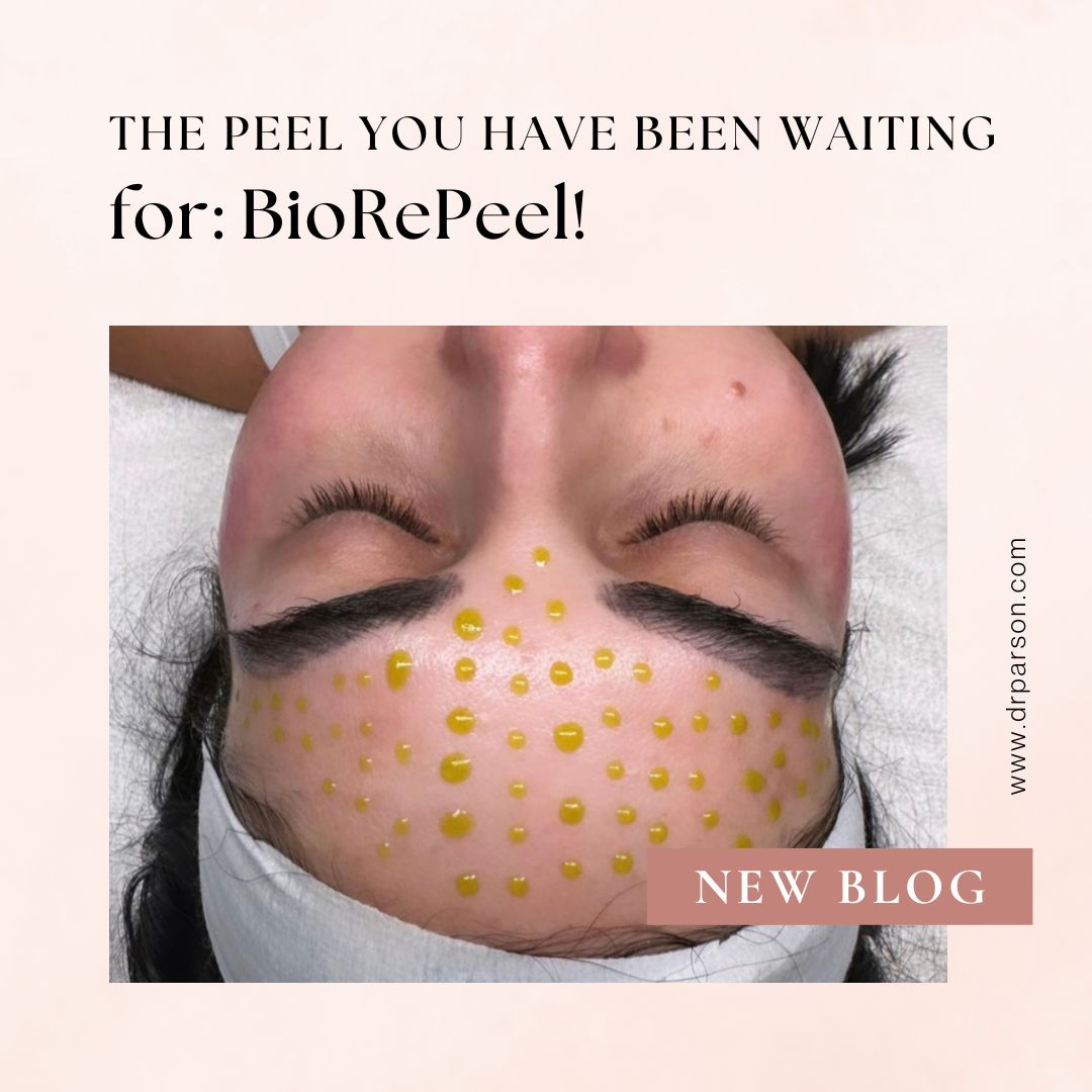 BioRePeel is here Blog Scottsdale | Dr. Shaun Parson Plastic Surgery & Skin Center