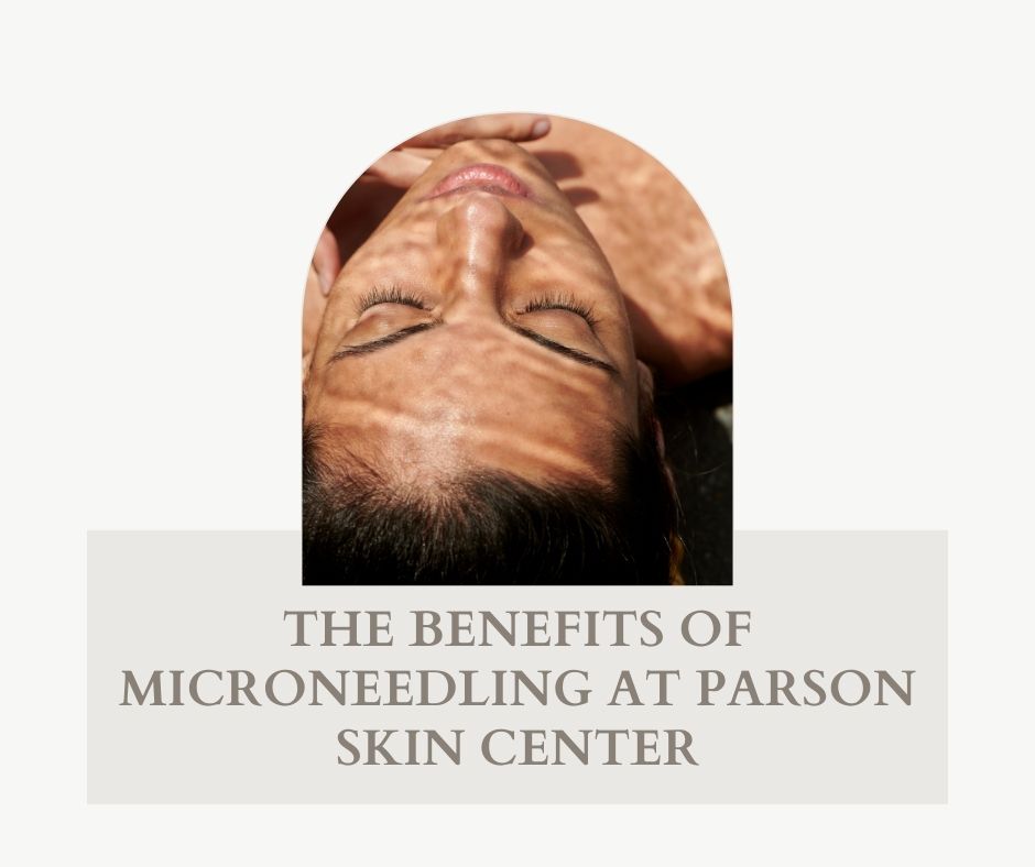 Microneedling | Parson Skin Center, Scottsdale