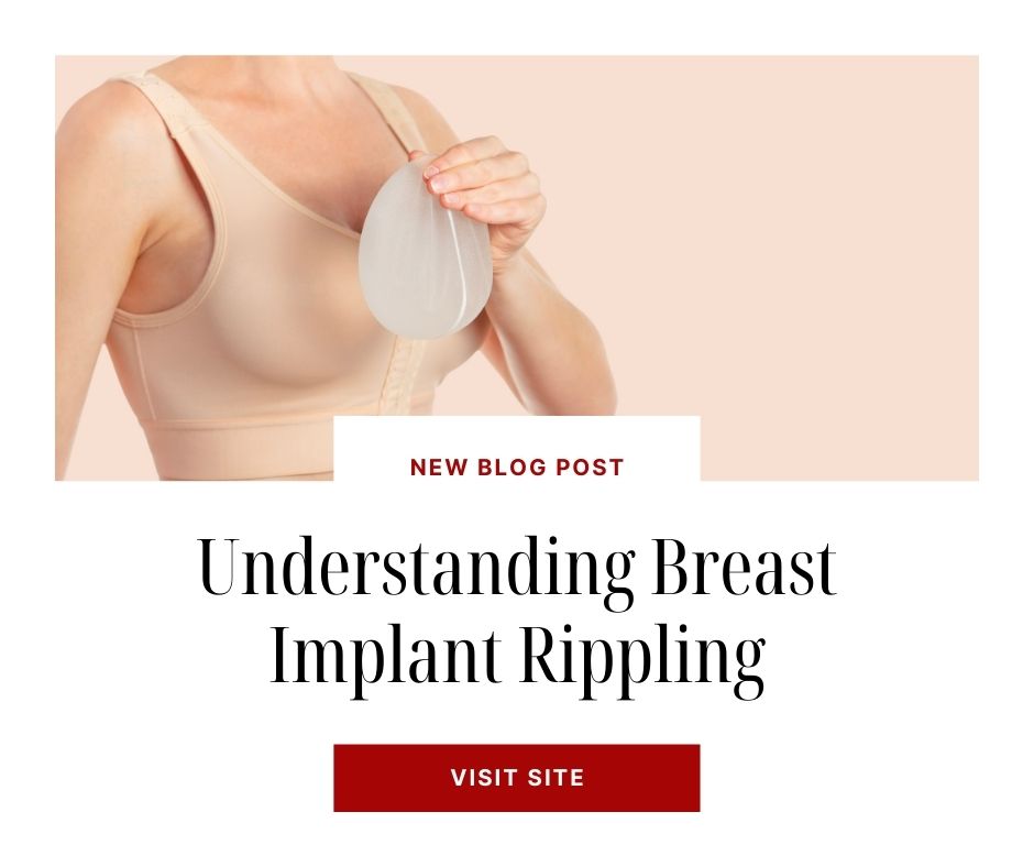 Understanding Breast Rippling | Dr. Shaun Parson Plastic Surgery