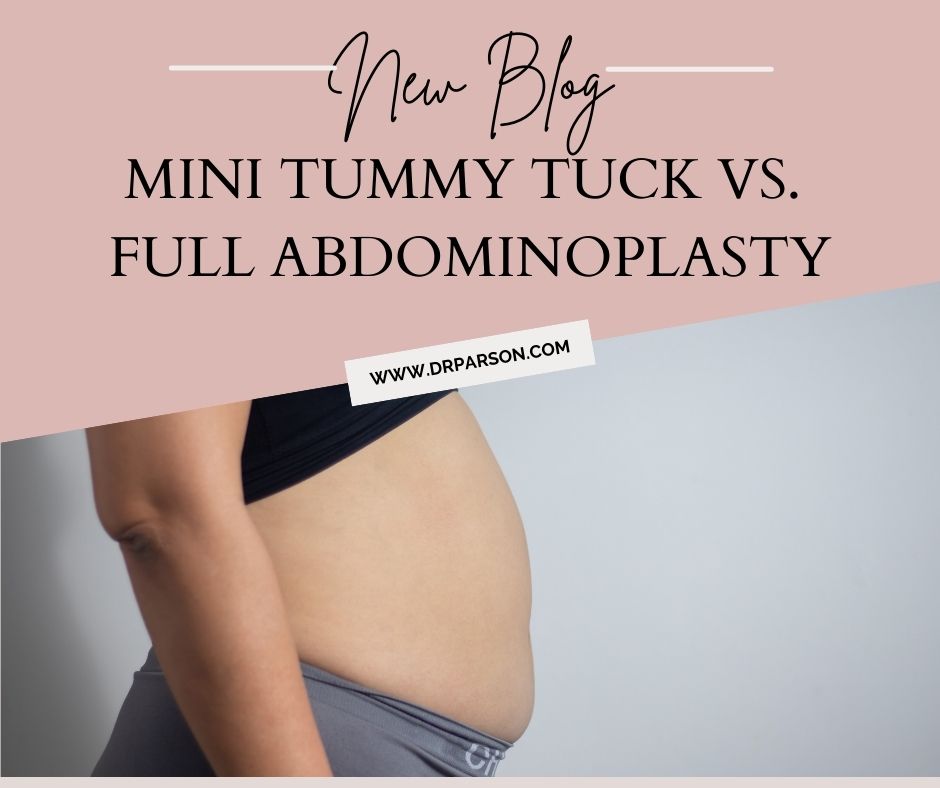 Which Tummy Tuck is right for you? | Dr. Shaun Parson, Scottsdale