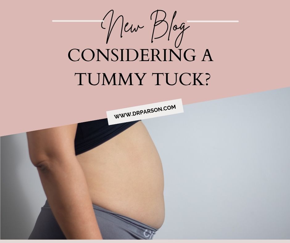 Tummy Tuck Phoenix | Dr. Shaun Parson